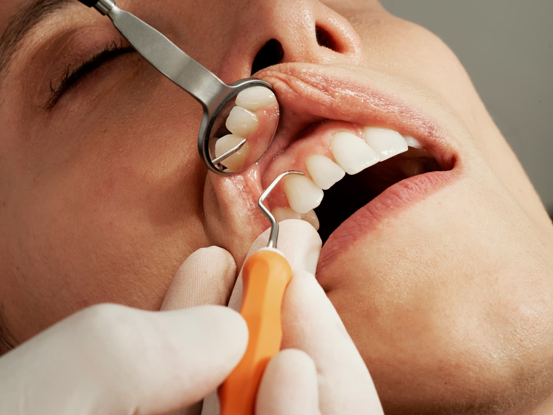 Comprehensive Routine Dental Exams & Cleanings